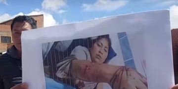 Familiares y padres de familia protestaron contra los dueños de los perros.