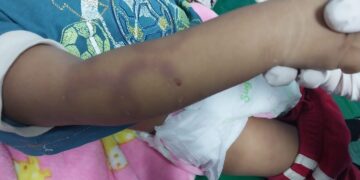 Una bebé de un año de edad murió golpeada y violada.