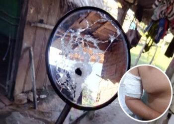 Tras el intento de robo, el emplado sufrió una herida en su brazo y deterioros en su motocicleta