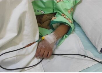 Un adolescente afectado por el incendio de un bus escolar está en terapia intensiva.
