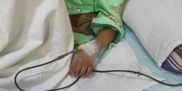Un adolescente afectado por el incendio de un bus escolar está en terapia intensiva.