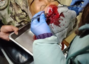 Uno de los militares agredidos.