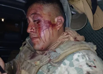 Uno de los militares atacados. Foto: VLCC.