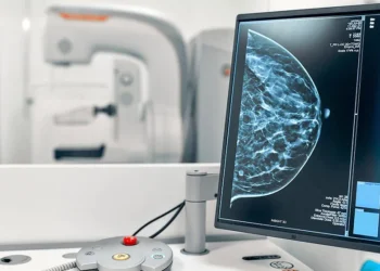 Un mamógrafo para identificar cáncer de mama. Foto: Ministerio de Hidrocarburos.