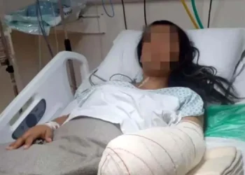 Una gestante con chikungunya perdió a su bebé. Foto referencial RRSS