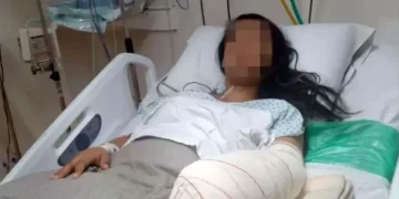 Una gestante con chikungunya perdió a su bebé. Foto referencial RRSS