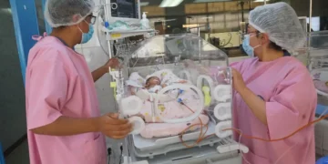 Los bebés prematuros son dependientes del oxígeno/APG