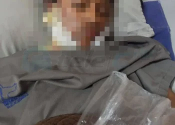 La víctima se recupera en el Hospital Viedma de Cochabamba. FOTO: RRSS