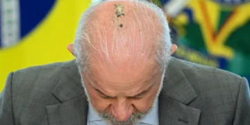 Lula fue operado de una lesión en la cabeza/AFP