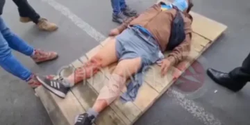 El periodista herido por la detonación de dinamita.
Foto: Captura Cadena A